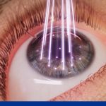 Training at the Tip of the Spear: The Evolution of Alcon’s Digital Training Initiatives Training at the Tip of the Spear